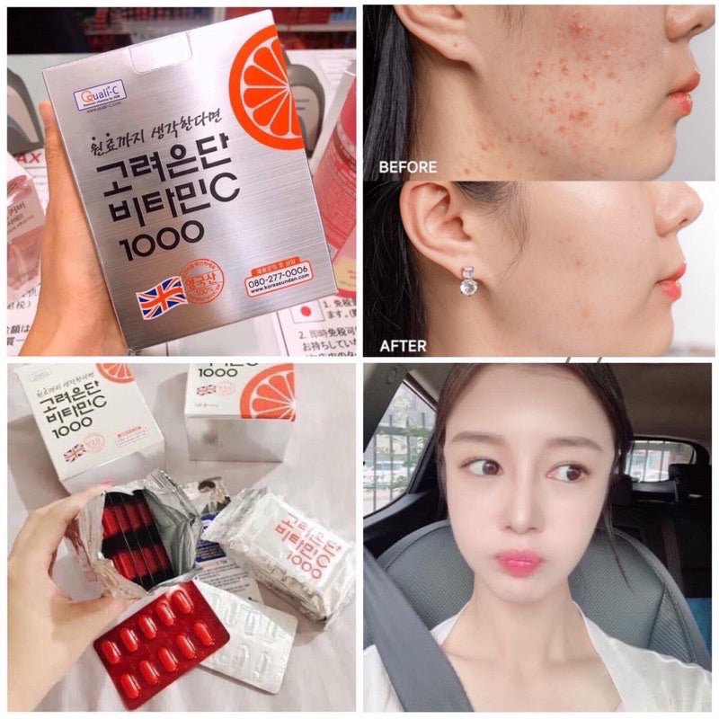 Viên Uống Vitamin C Eundan Số 1 Tại Hàn Quốc Trắng Da Chống Nắng Giảm Rụng Tóc Sản Sinh Collagen Trẻ Hóa