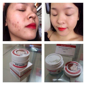 Kem trị mụn ciracle red spot cream