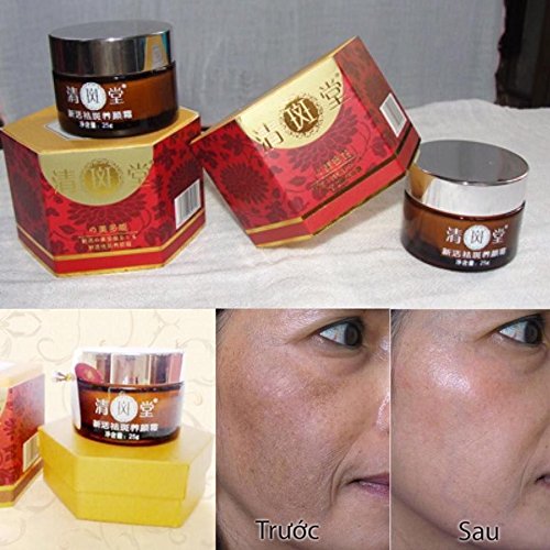 01 Boxes - Kem vua trị nám của nhật bản - Whitening Cream JAPANESE